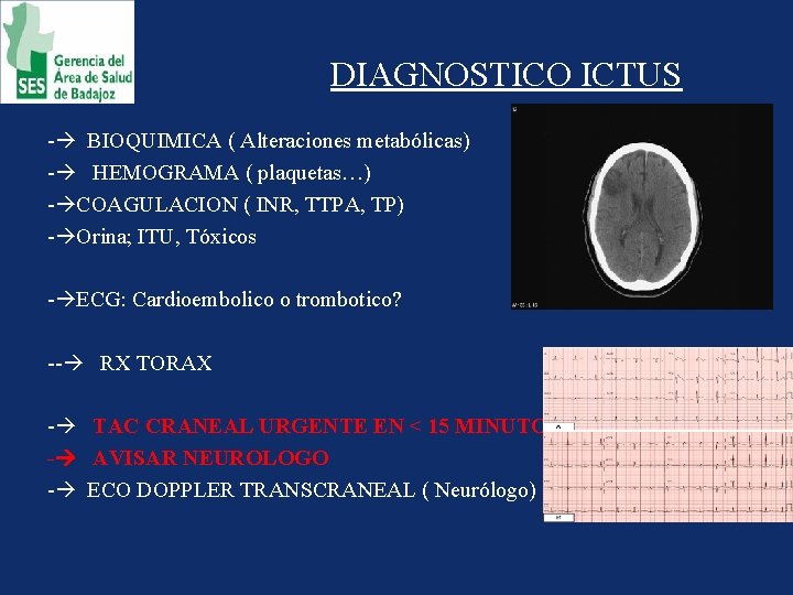 DIAGNOSTICO ICTUS - BIOQUIMICA ( Alteraciones metabólicas) - HEMOGRAMA ( plaquetas…) - COAGULACION (