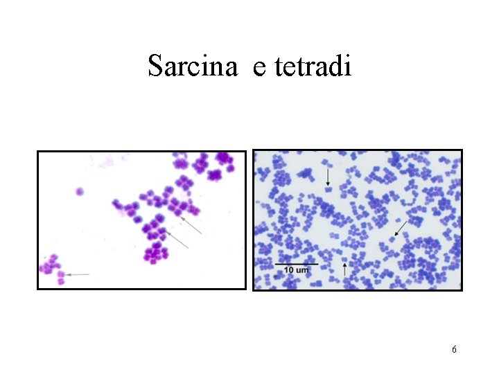 Sarcina e tetradi 6 