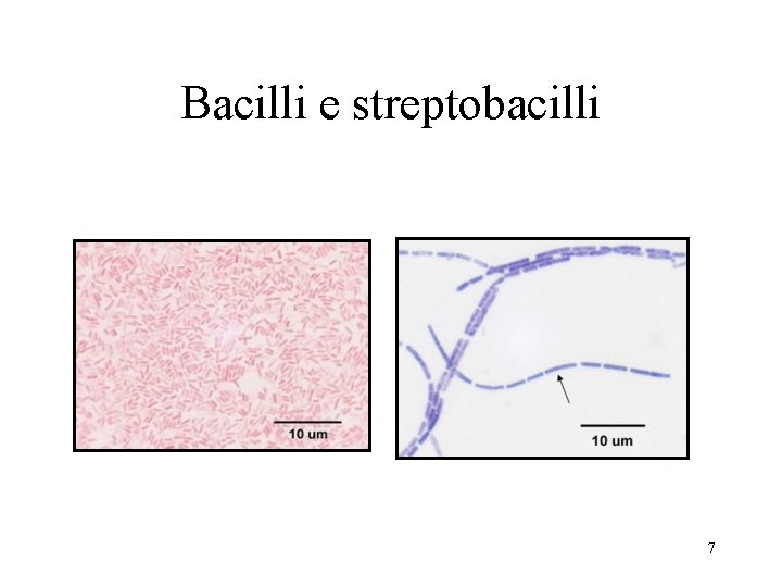 Bacilli e streptobacilli 7 