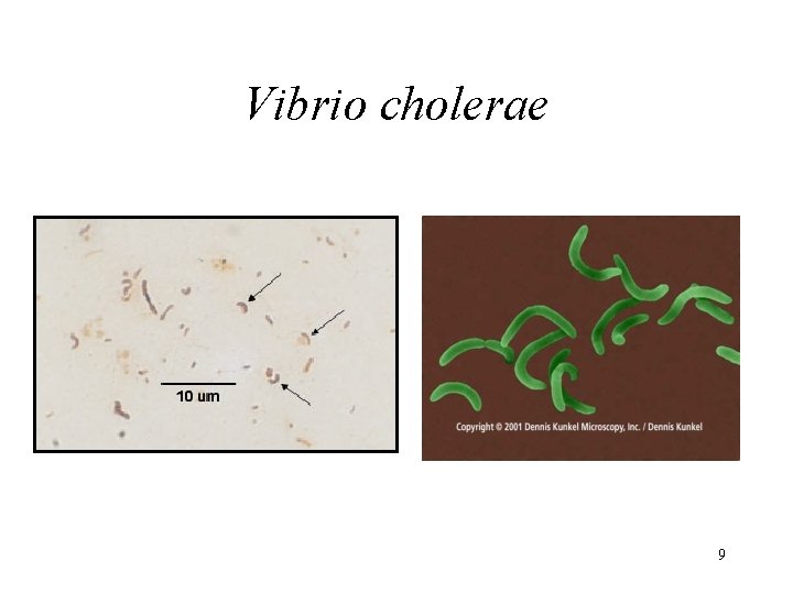 Vibrio cholerae 9 