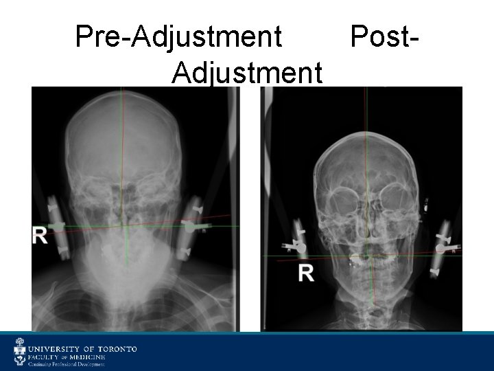 Pre-Adjustment Post. Adjustment 