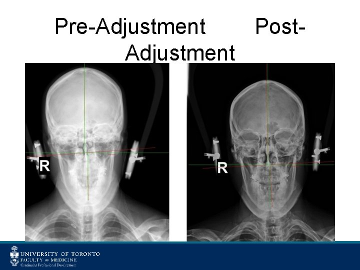 Pre-Adjustment Post. Adjustment 