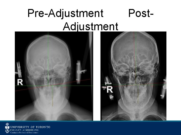 Pre-Adjustment Post. Adjustment 