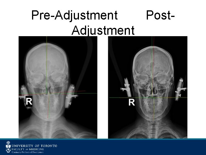 Pre-Adjustment Post. Adjustment 
