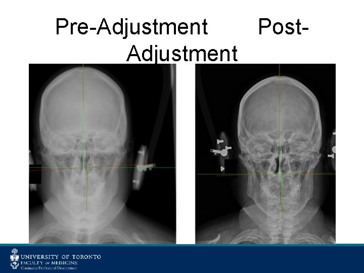 Pre-Adjustment Post. Adjustment 