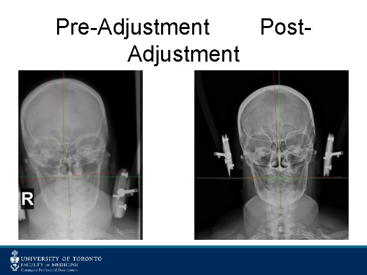 Pre-Adjustment Post. Adjustment 