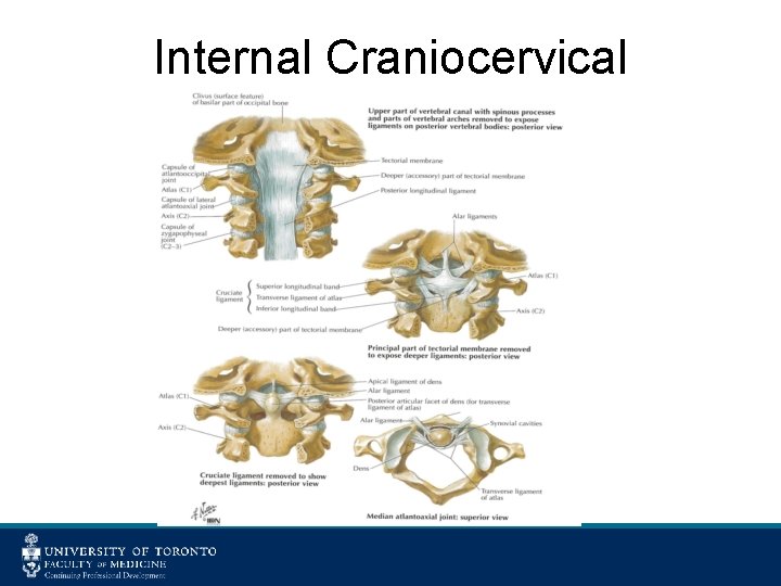 Internal Craniocervical Ligaments 