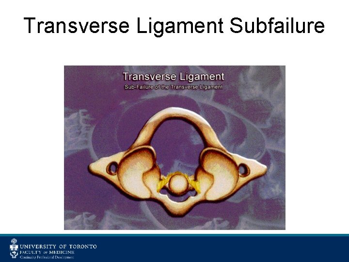 Transverse Ligament Subfailure 