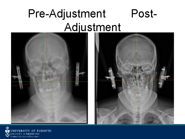 Pre-Adjustment Post. Adjustment 