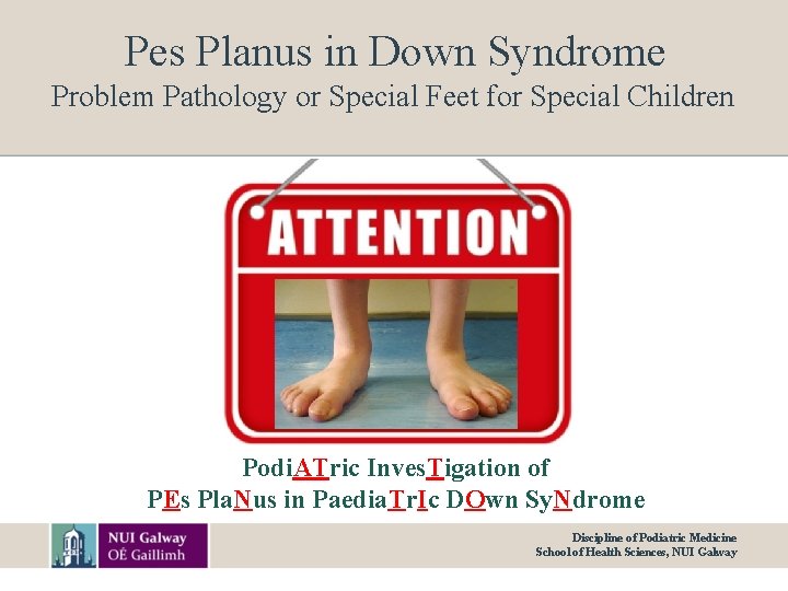 Pes Planus in Down Syndrome Problem Pathology or Special Feet for Special Children Podi.