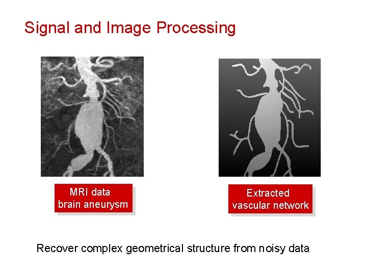 Signal and Image Processing MRI data brain aneurysm Extracted vascular network Recover complex geometrical