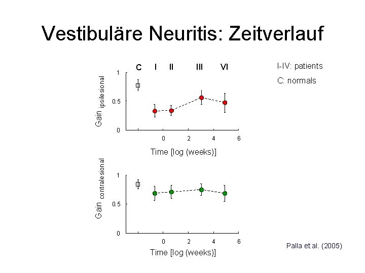 Gain ipsilesional Vestibuläre Neuritis: Zeitverlauf 1 C I II I-IV: patients VI C: normals