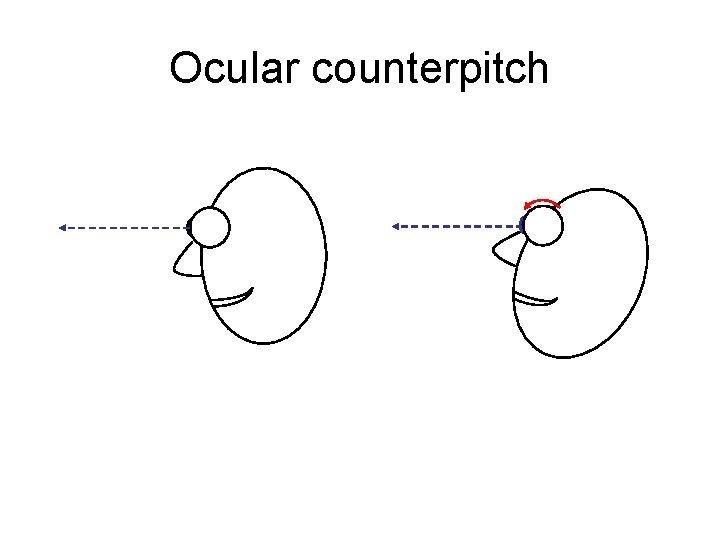 Ocular counterpitch 