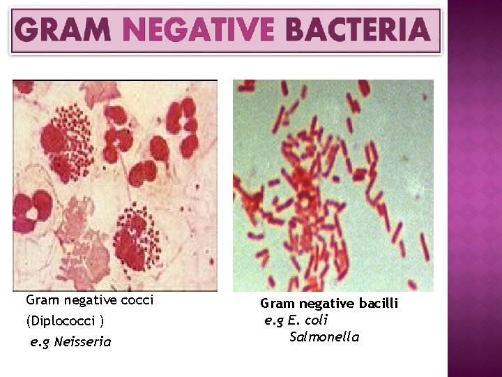 Gram negative cocci (Diplococci ) e. g Neisseria Gram negative bacilli e. g E.