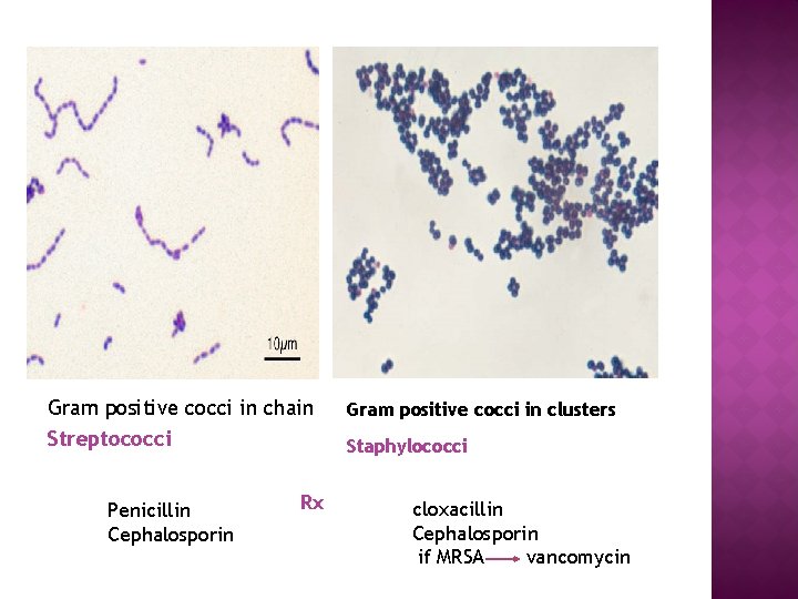 Gram positive cocci in chain Gram positive cocci in clusters Streptococci Staphylococci Penicillin Cephalosporin