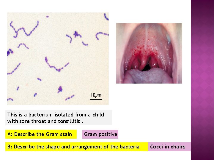 This is a bacterium isolated from a child with sore throat and tonsillitis. A: