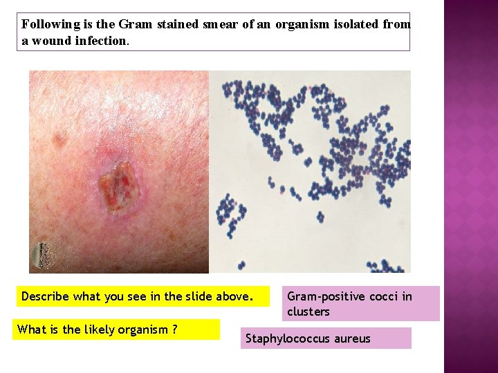 Following is the Gram stained smear of an organism isolated from a wound infection.