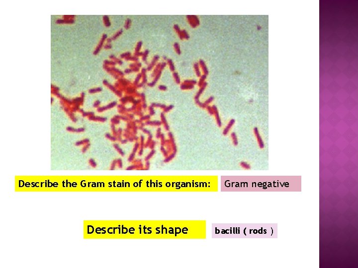 Describe the Gram stain of this organism: Describe its shape Gram negative bacilli (
