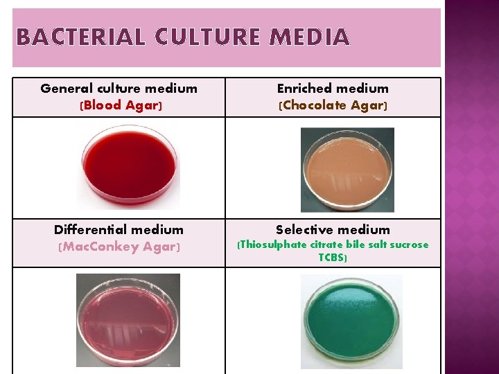 BACTERIAL CULTURE MEDIA General culture medium (Blood Agar) Enriched medium (Chocolate Agar) Differential medium