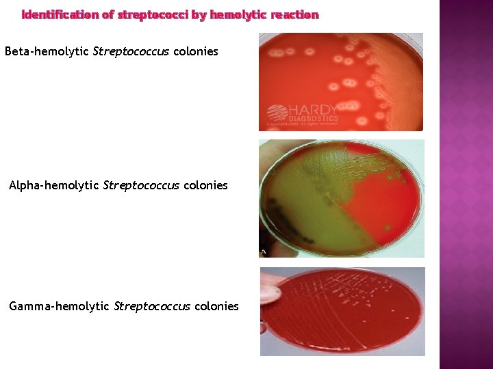 Identification of streptococci by hemolytic reaction Beta-hemolytic Streptococcus colonies Alpha-hemolytic Streptococcus colonies Gamma-hemolytic Streptococcus