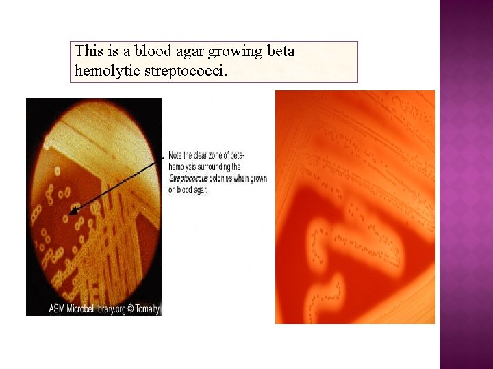 This is a blood agar growing beta hemolytic streptococci. 