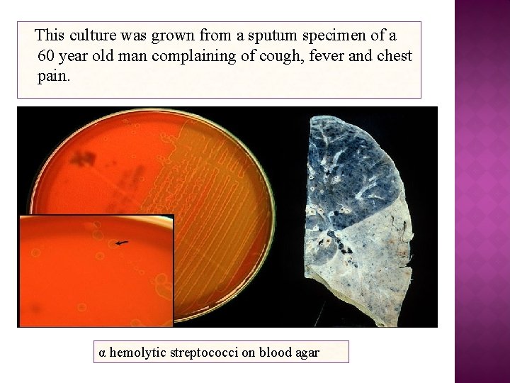 This culture was grown from a sputum specimen of a 60 year old man This culture was grown from a sputum specimen of a 60 year old man