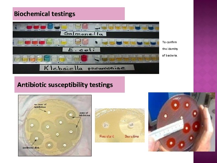 Biochemical testings To confirm the identity of bacteria. Antibiotic susceptibility testings 