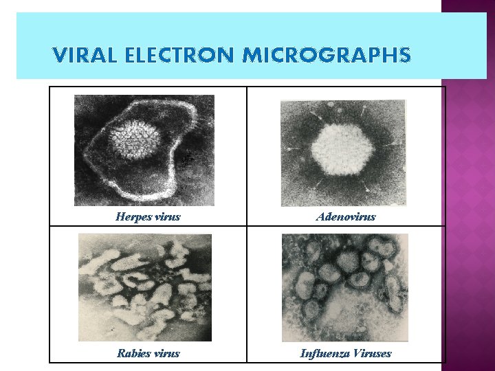 VIRAL ELECTRON MICROGRAPHS Herpes virus Adenovirus Rabies virus Influenza Viruses VIRAL ELECTRON MICROGRAPHS Herpes virus Adenovirus Rabies virus Influenza Viruses