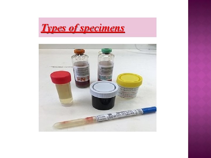 Types of specimens 