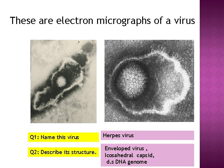 These are electron micrographs of a virus Q 1: Name this virus Q 2: