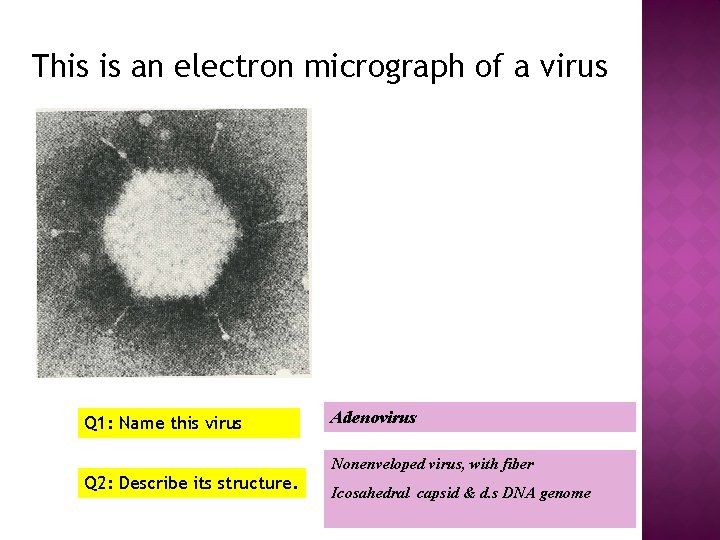 This is an electron micrograph of a virus Q 1: Name this virus Q