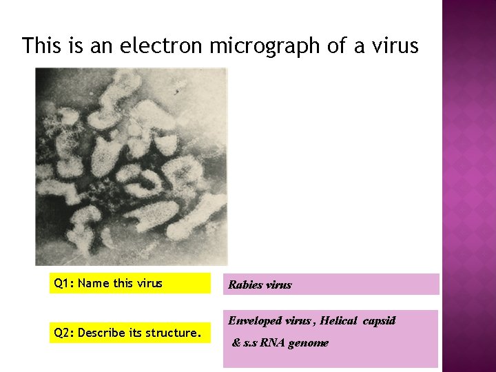 This is an electron micrograph of a virus Q 1: Name this virus Q