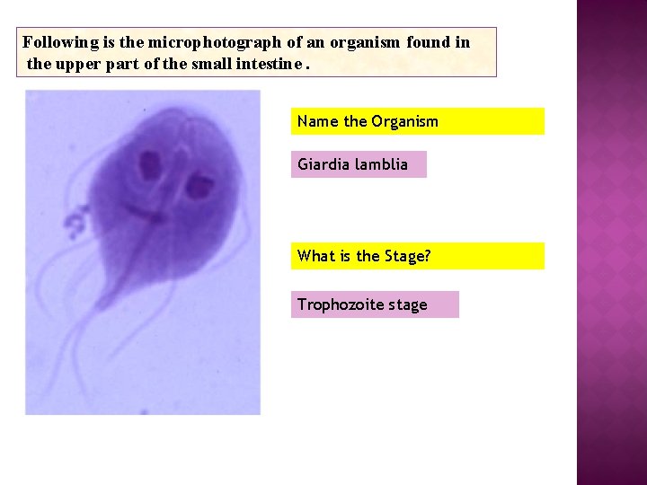 Following is the microphotograph of an organism found in the upper part of the