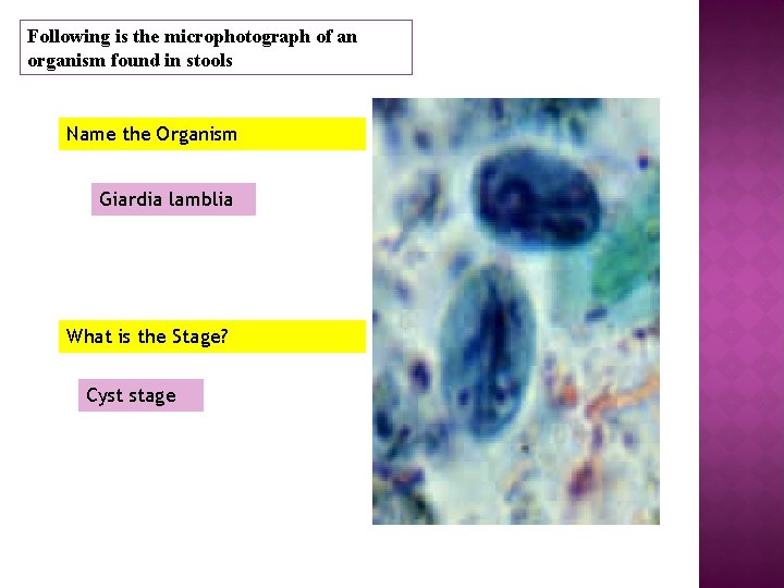 Following is the microphotograph of an organism found in stools Name the Organism Giardia