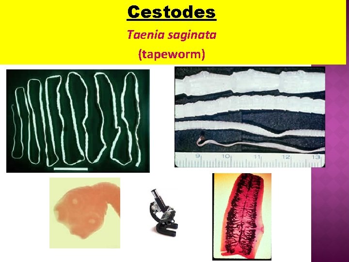 Cestodes Taenia saginata (tapeworm) Cestodes Taenia saginata (tapeworm)