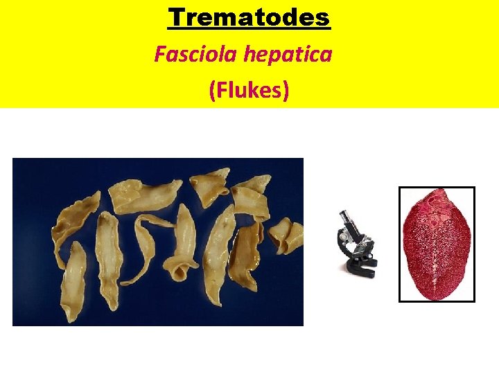 Trematodes Fasciola hepatica (Flukes) 