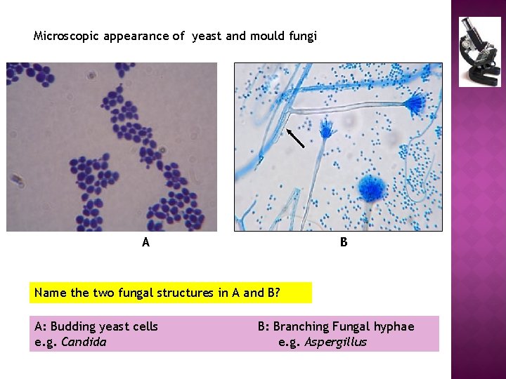 Microscopic appearance of yeast and mould fungi A B Name the two fungal structures