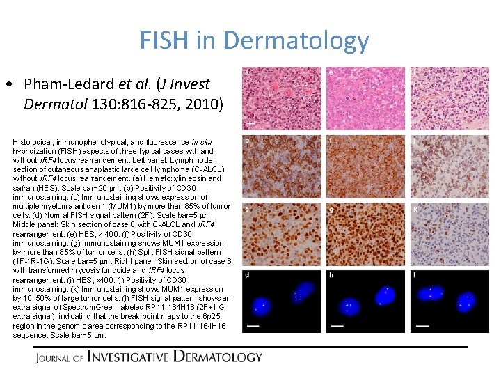 Research Techniques Made Simple Fluorescence In Situ Hybridization