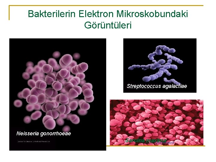 Bakterilerin Elektron Mikroskobundaki Görüntüleri Streptococcus agalactiae Neisseria gonorrhoeae Sarcina maxima 