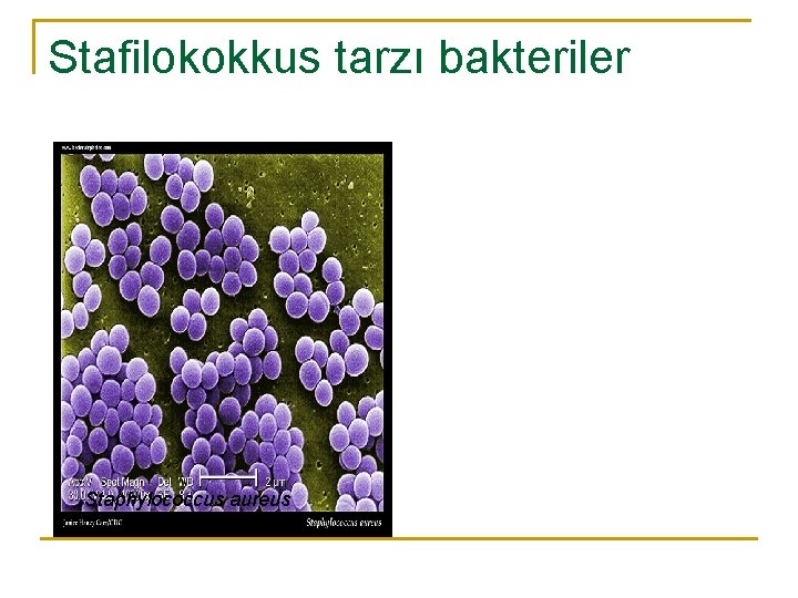 Stafilokokkus tarzı bakteriler Staphylococcus aureus 