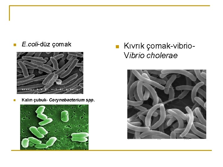 n E. coli-düz çomak n Kalın çubuk- Corynebacterium spp. n Kıvrık çomak-vibrio. Vibrio cholerae