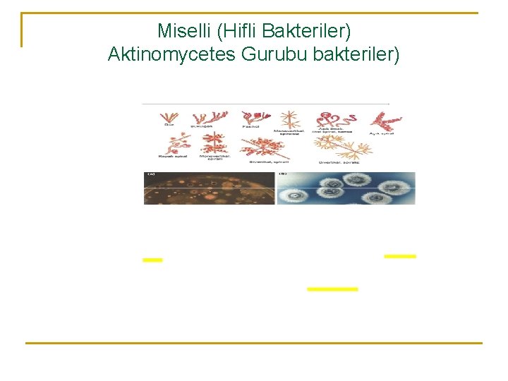 Miselli (Hifli Bakteriler) Aktinomycetes Gurubu bakteriler) 