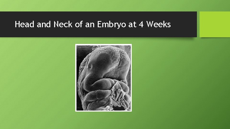 Head and Neck of an Embryo at 4 Weeks 