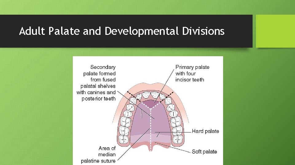 Adult Palate and Developmental Divisions 