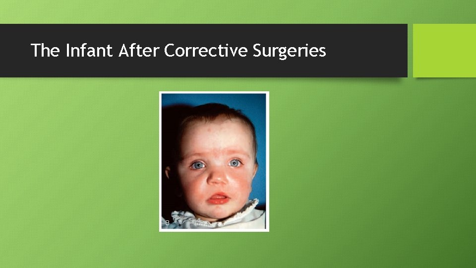 The Infant After Corrective Surgeries 