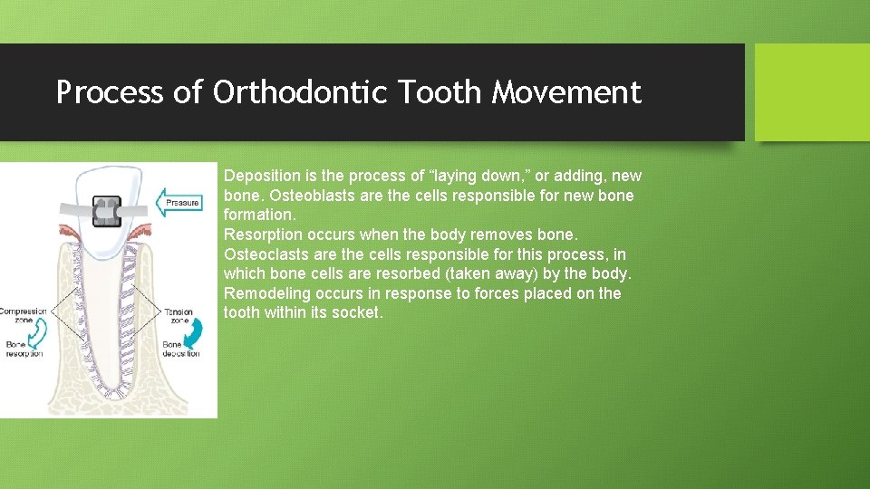 Process of Orthodontic Tooth Movement Deposition is the process of “laying down, ” or