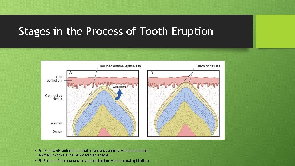 Stages in the Process of Tooth Eruption • A, Oral cavity before the eruption
