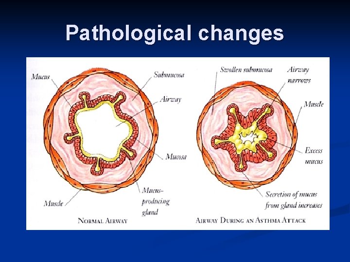 Pathological changes 