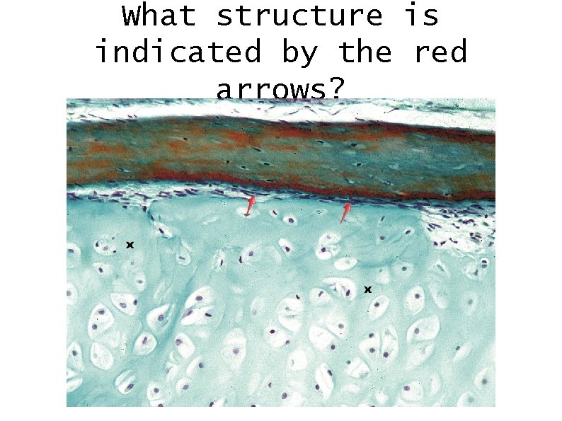What structure is indicated by the red arrows? 