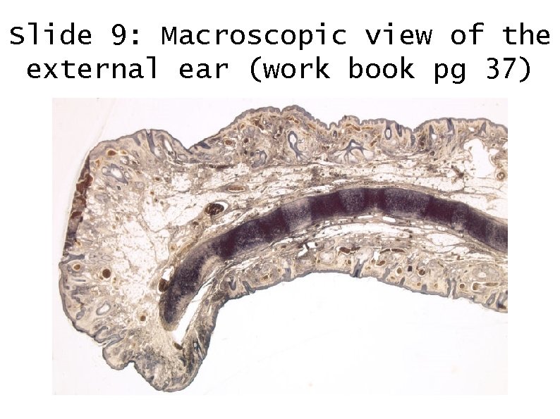 Slide 9: Macroscopic view of the external ear (work book pg 37) 
